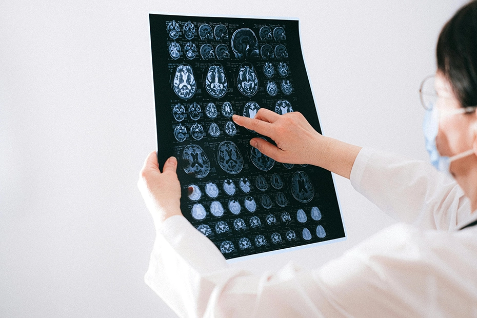 Prevention strategies can be very effective in reducing the risk of developing dementia