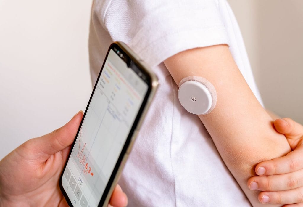 Preventivno spremljanje sladkorja ni namenjeno le diabetikom. Vedno več zdravih posameznikov uporablja naprave za vpogled v osebni presnovni odziv na hrano, stres in gibanje.